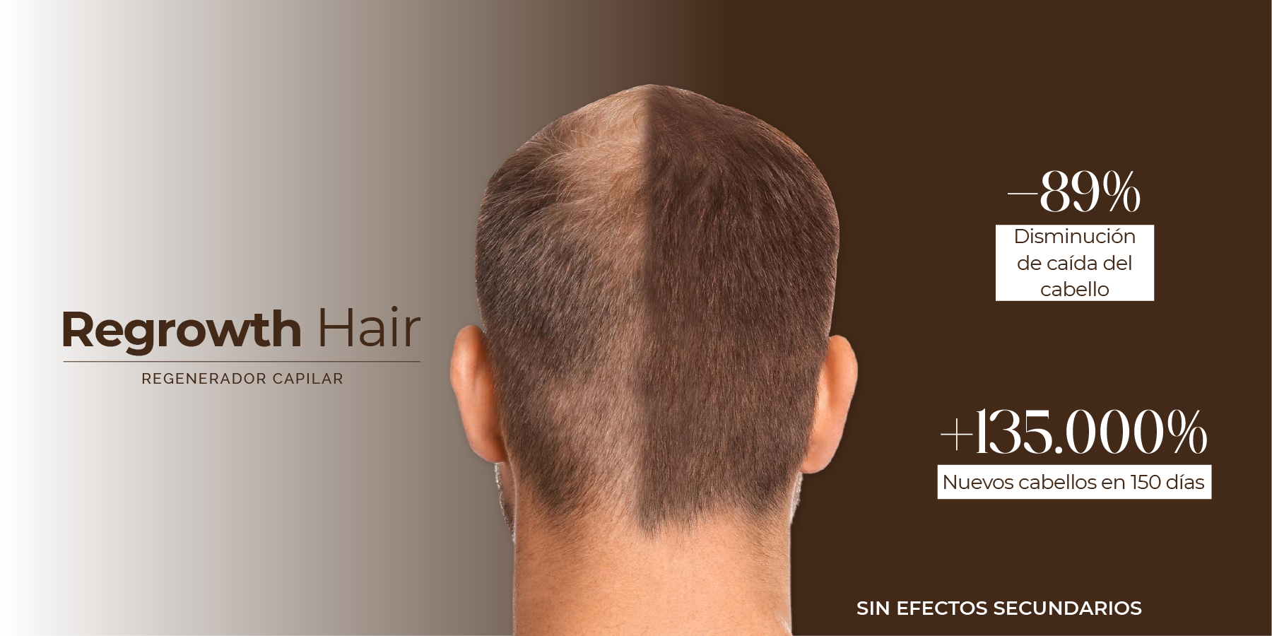 Una solución eficaz para la caída del cabello, que genera nuevos cabellos y disminuye la caída. Una solución eficaz para la caída del cabello, que genera nuevos cabellos y disminuye la caída.